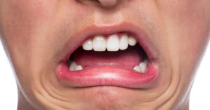 Staff Asked to Brush Each Other's Teeth